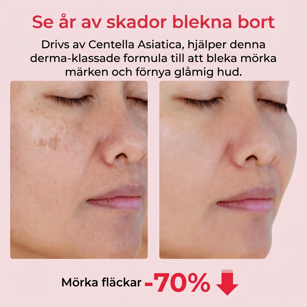 4. Minskar synligheten av mörka fläckar och gamla märken