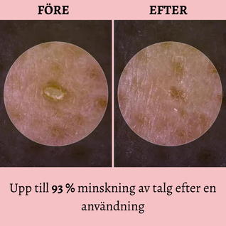 Peelie - Klarare hud utan synliga porer