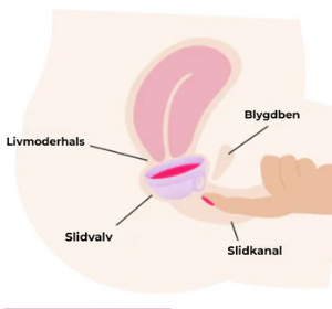 2. Placerar sig själv